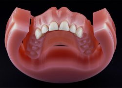 Dyski PMMA na płyty protez 20mm