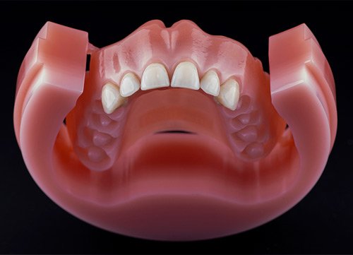 Dyski PMMA na płyty protez 20mm