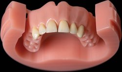 Dyski PMMA na płyty protez 25mm