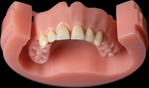 Dyski PMMA na płyty protez 25mm